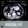 an x-ray of a person's body visceral fat MRI scan