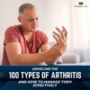 Unveiling the 100 Types of Arthritis and How to Manage Them Effectively