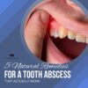 5 Natural Remedies For a Tooth Abscess That Actually Work